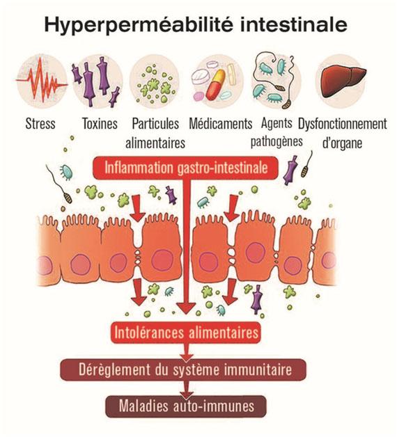 Asthme, emphysème, allergies, pathologies respiratoires : l’intestin perméable (Leaky Gut)